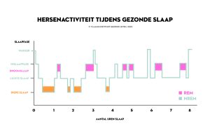 Hyponogram van normale slaap: doorlopen van slaapfases tijdens de nacht